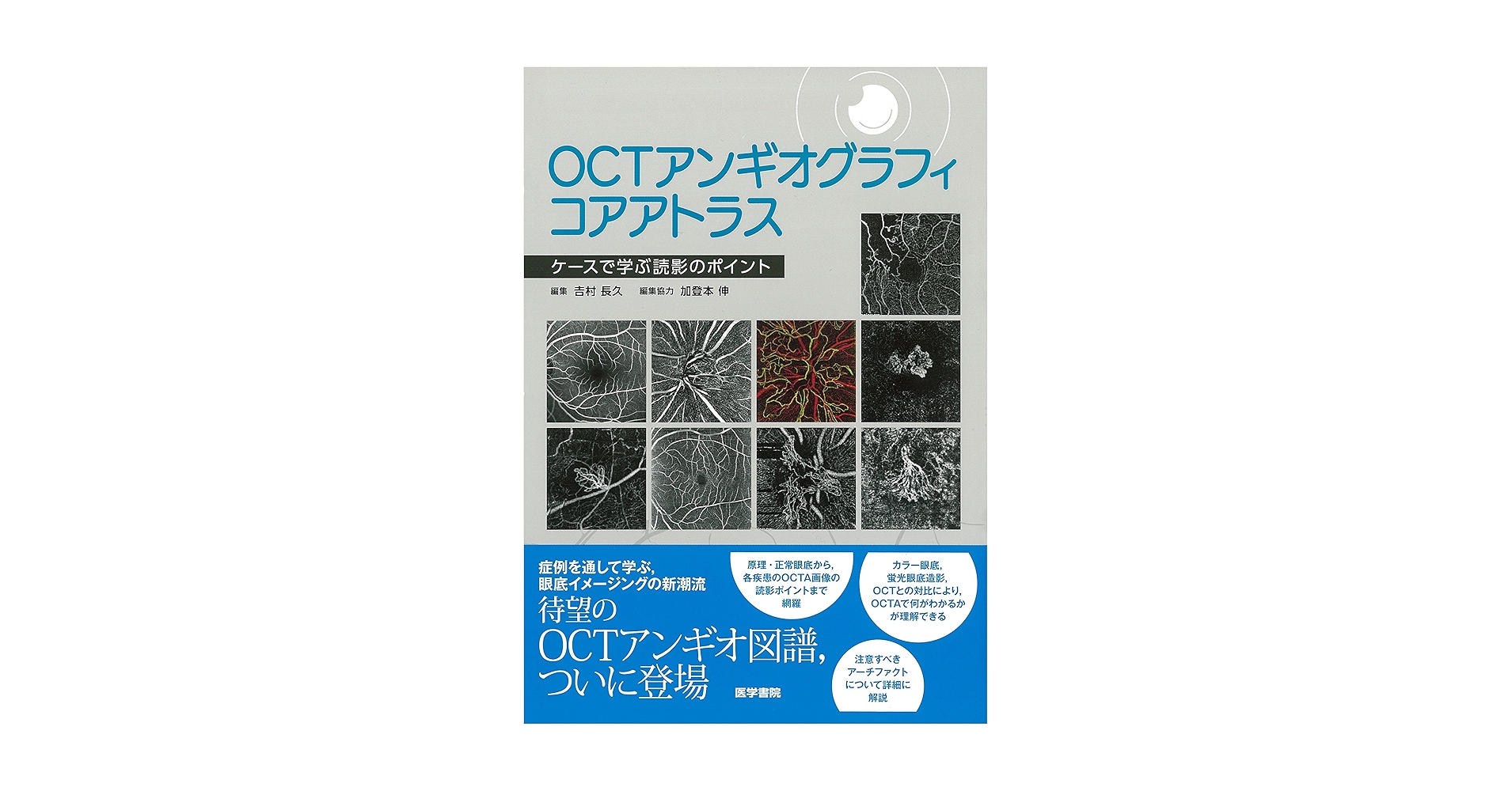 OCTアトラス 第2版 Amazon.co.jp: OCTアトラス 第2版 : 吉村 長久, 板谷 正紀, 辻川