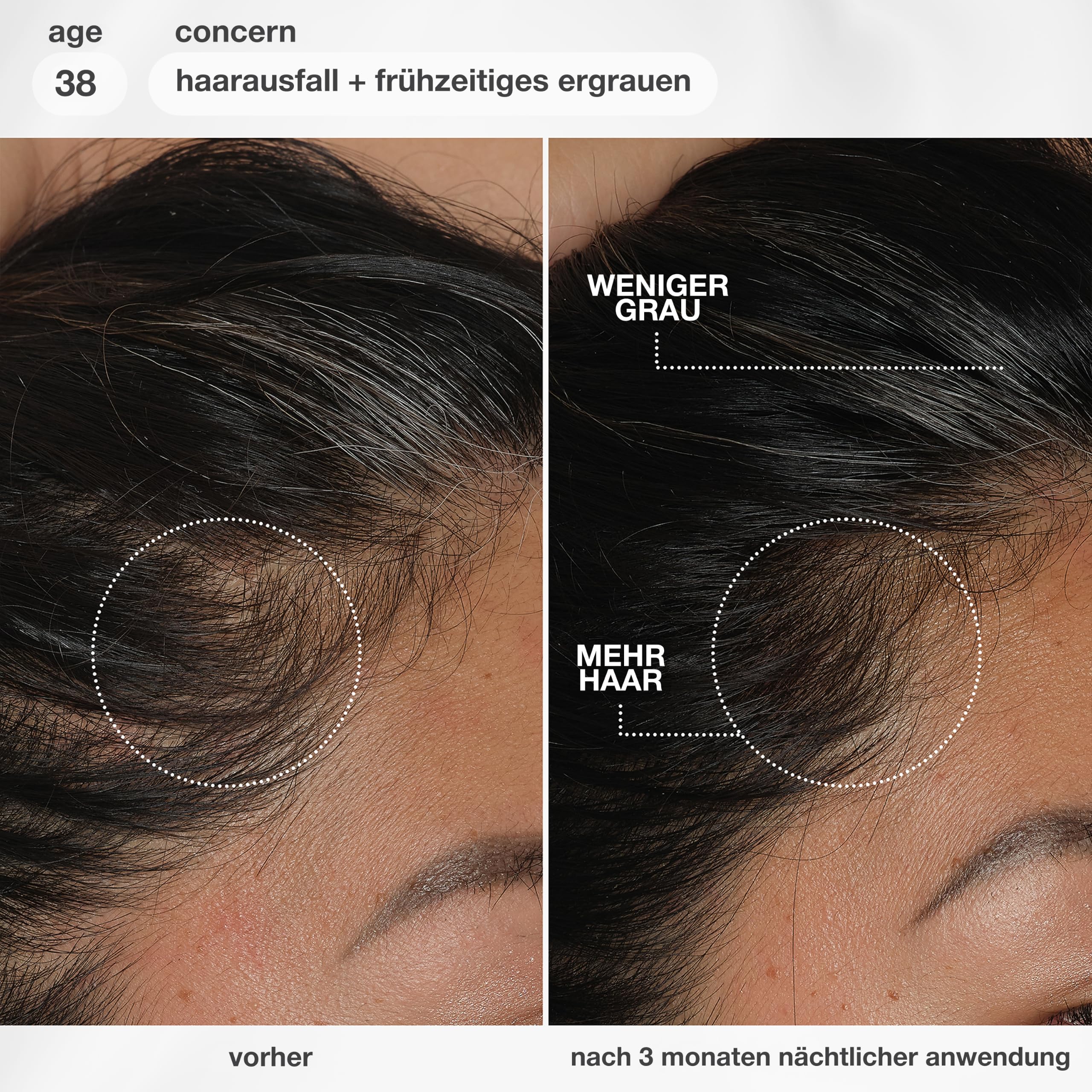 K18 FutureIQ Biomimetisches Kopfhautserum für Haarlanglebigkeit, 90 ml | Mit MultiVital Tech für bis zu 19.000 mehr Haare, weniger graue Haare, stärkere Kopfhautbarriere, parfümfrei & vegan
