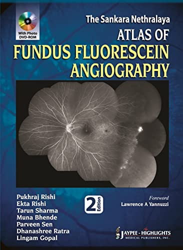 The Sankara Nethralaya Atlas of Fundus Fluorescein Angiography