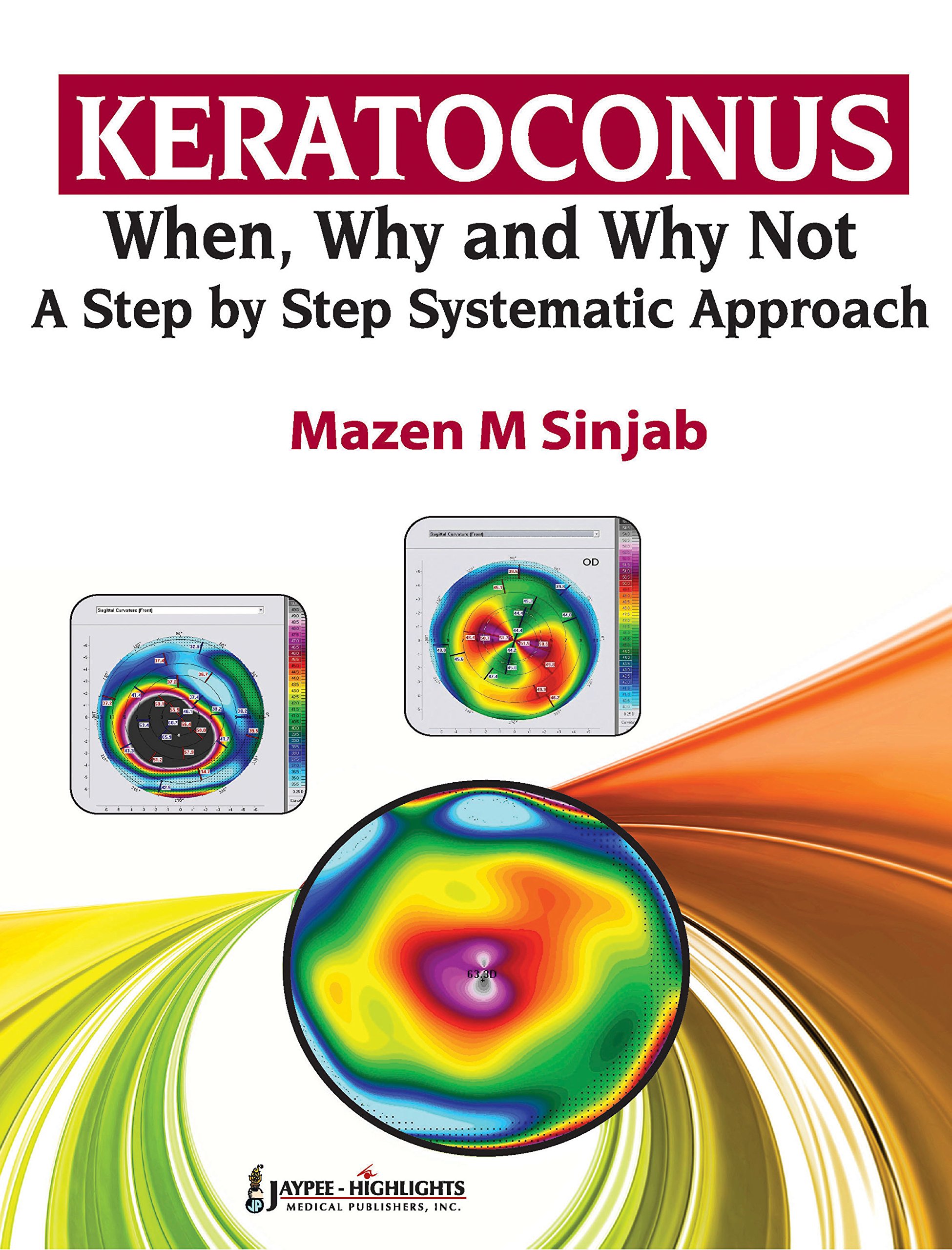 Buy Keratoconus: When, Why and Why Not-A Step-by-Step Systematic ...