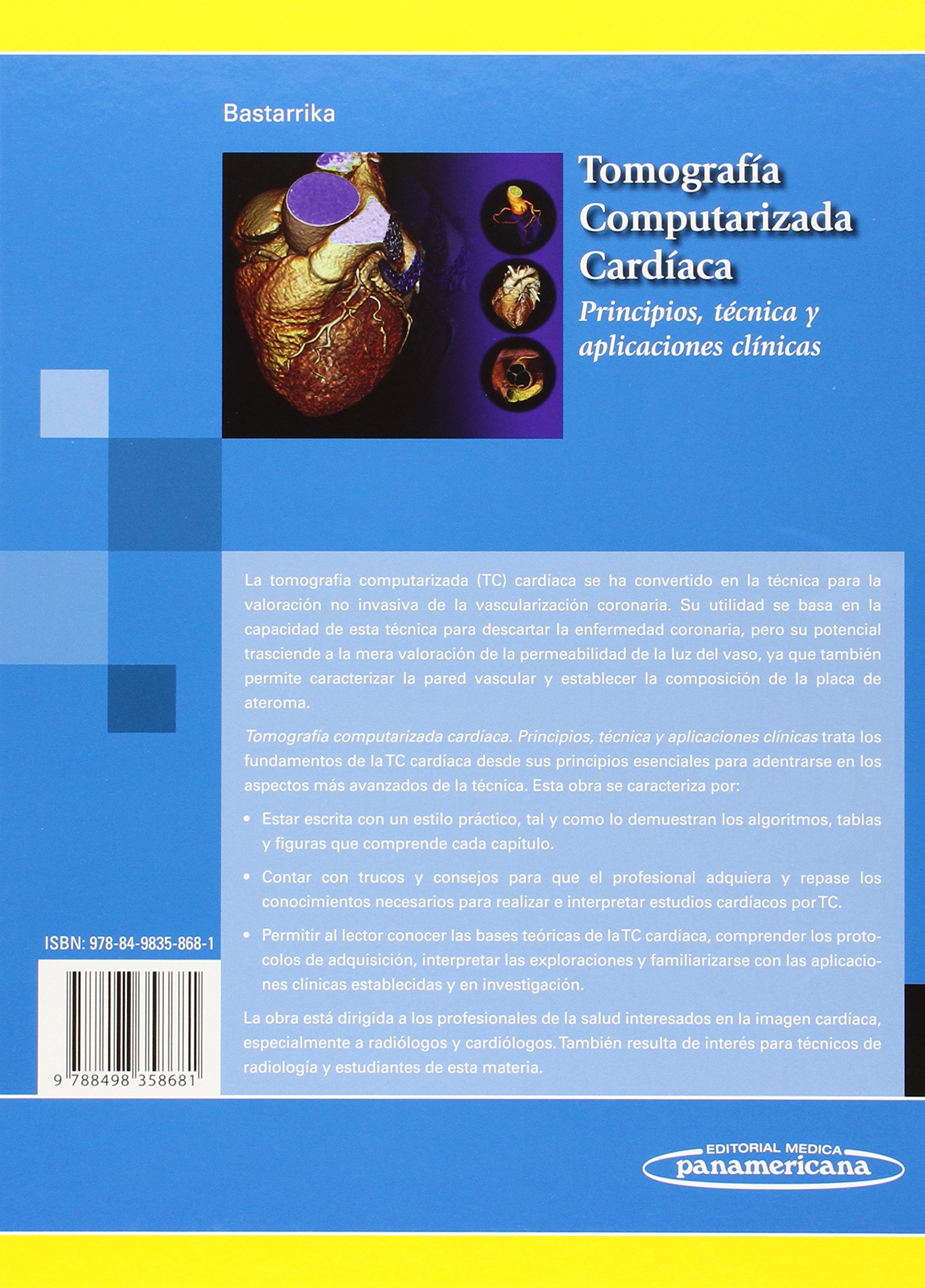 Tomografía Computarizada Cardíaca. Principios, técnica y aplicaciones clínicas