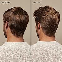 Vista 3 de Tea Tree Scalp Care Regeniplex - Espuma de elevación de raíces, mousse voluminizadora, para cabello fino, 6.8 onzas líquidas