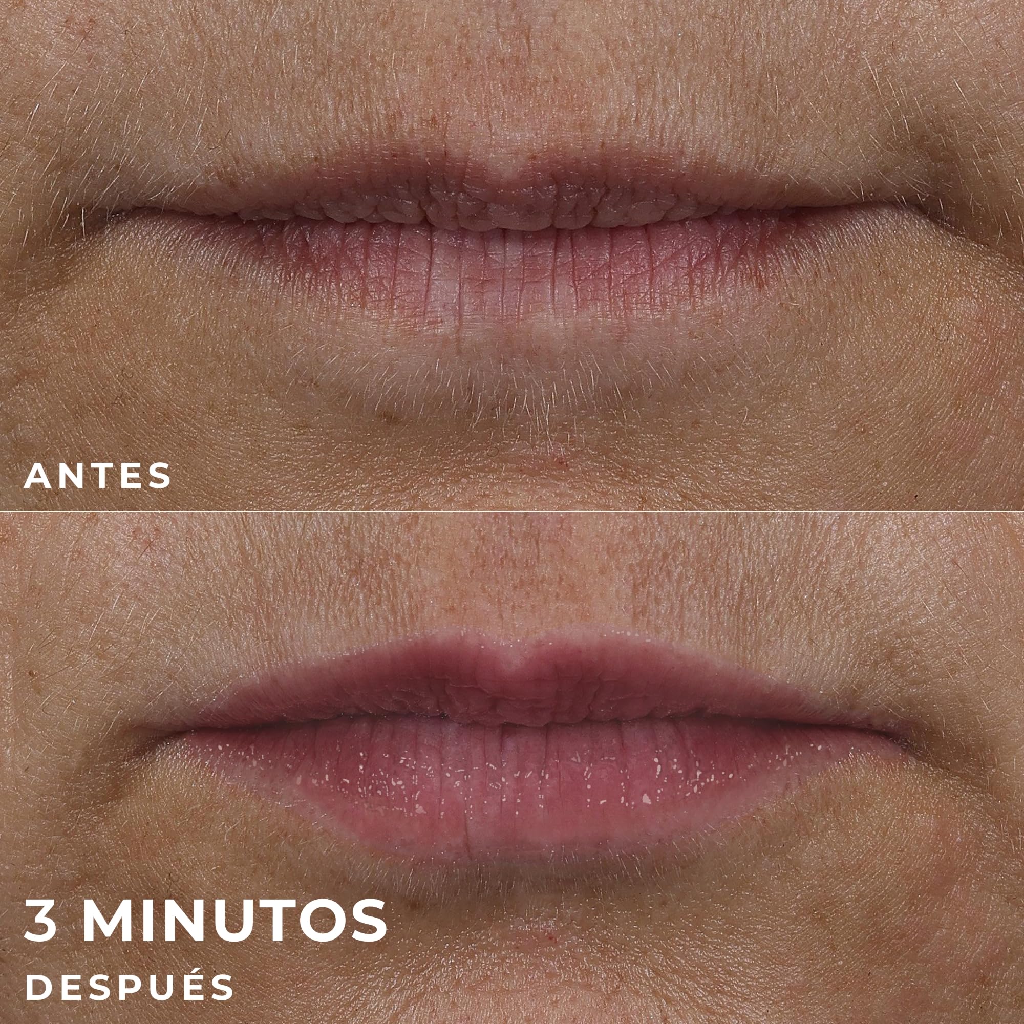 RoC Derm Correxion Lip Volumizer | Bálsamo Rellenador para Labios con Ácido Hialurónico y Péptidos de Colágeno | 10 ml