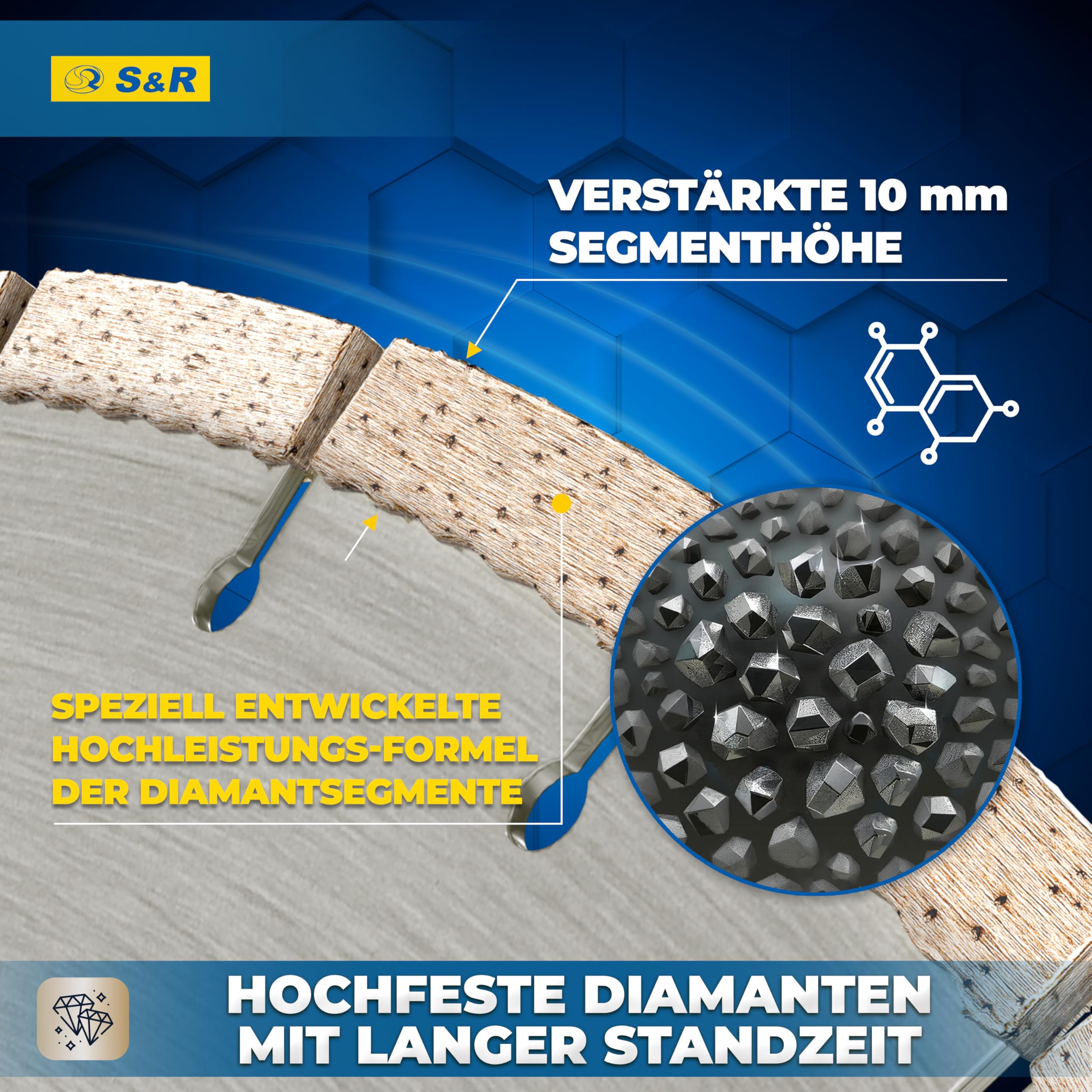 S&R Diamanttrennscheibe 400 x 25.4 x 3.0 x 10 mm in Industrie-Qualität, Diamant-Trennscheibe für Naturstein, Kunststein, Sandstein, Hartziegel, für Motortrennsägen und Tischsägen