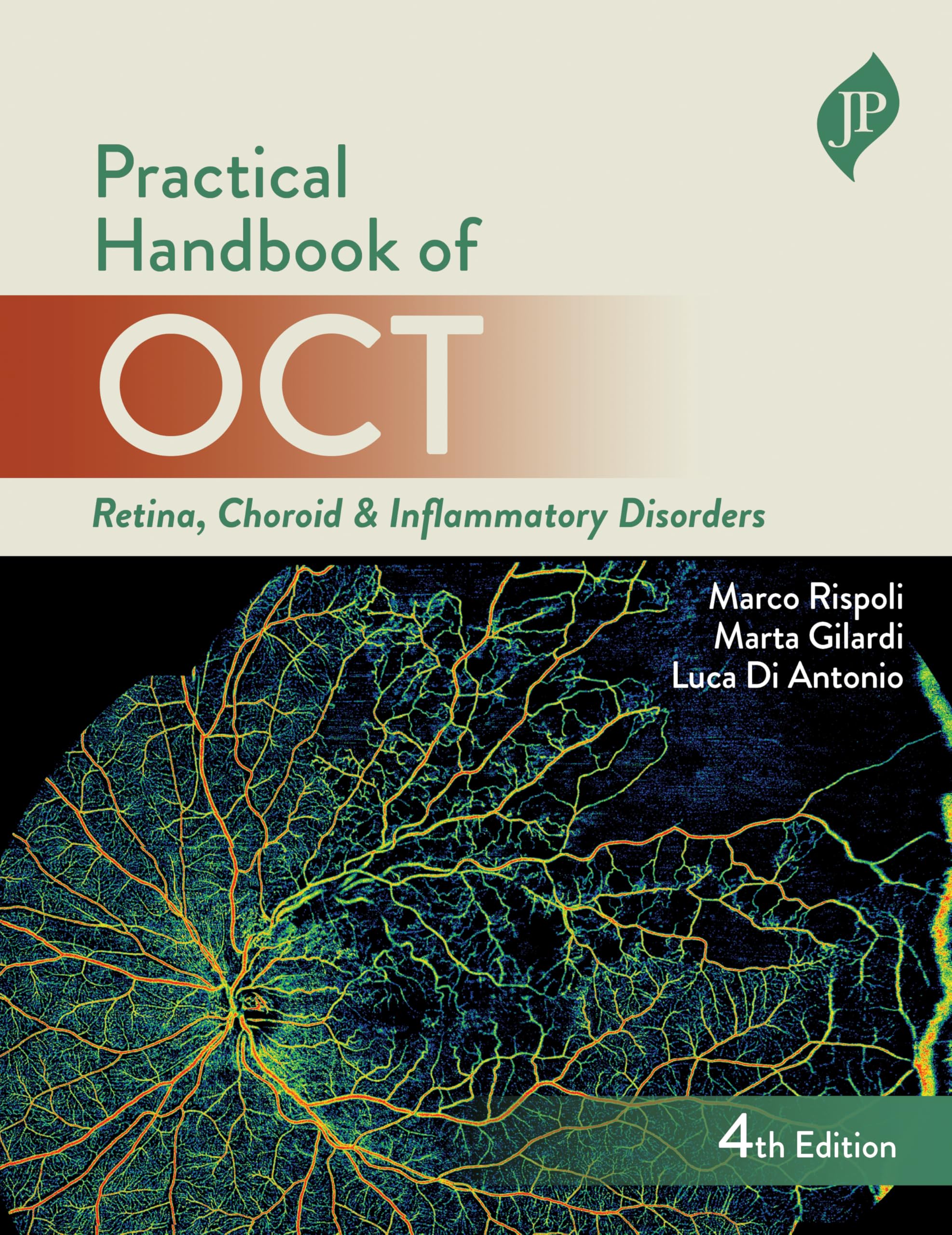 Practical Handbook of OCT (Retina, Choroid & Inflammatory Disorders) (English Edition)