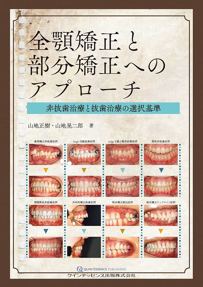 全顎矯正と部分矯正へのアプローチ 全顎矯正と部分矯正へのアプローチ | 山地 正樹, 山地 晃二郎