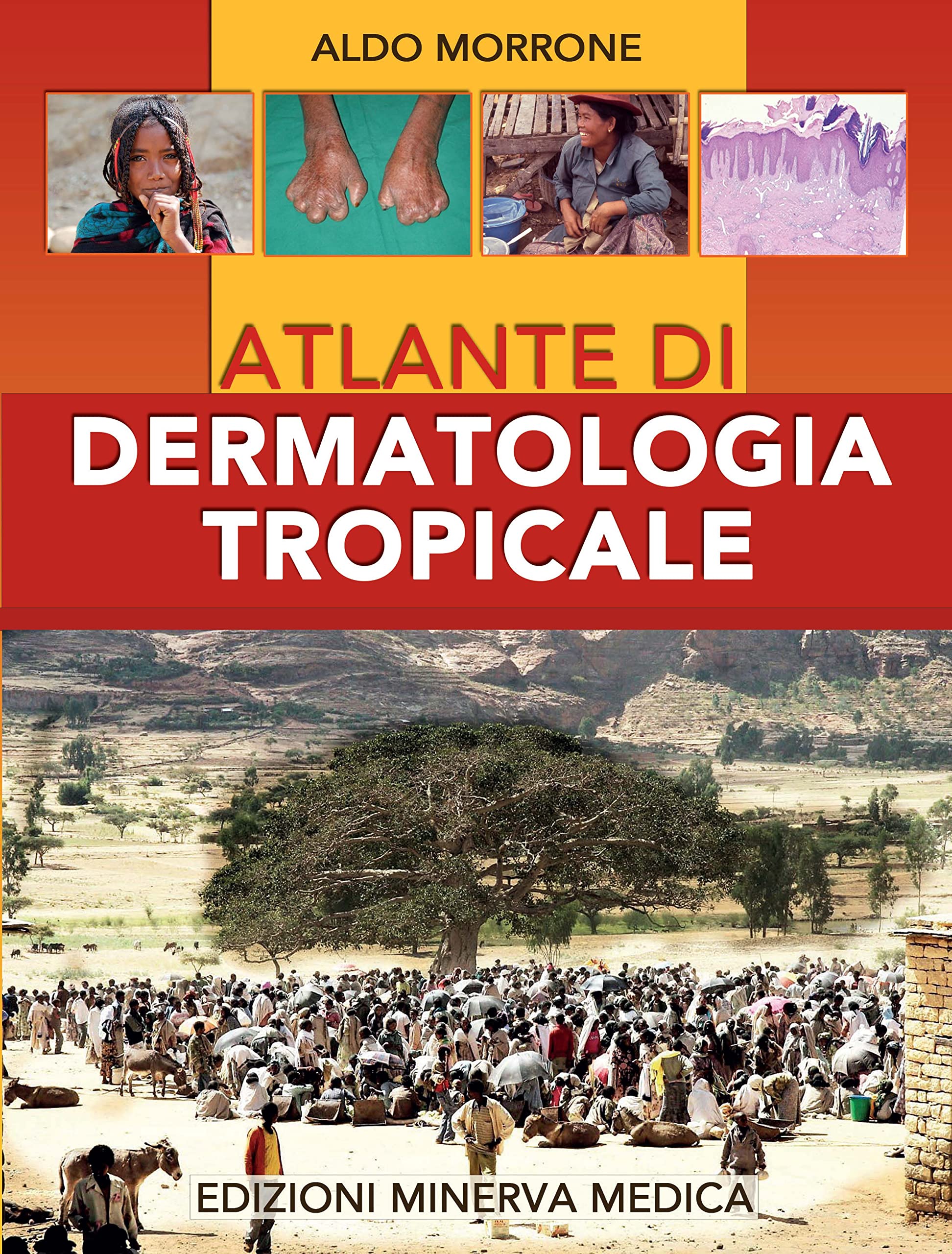Minerva Atlante di dermatologia tropicale