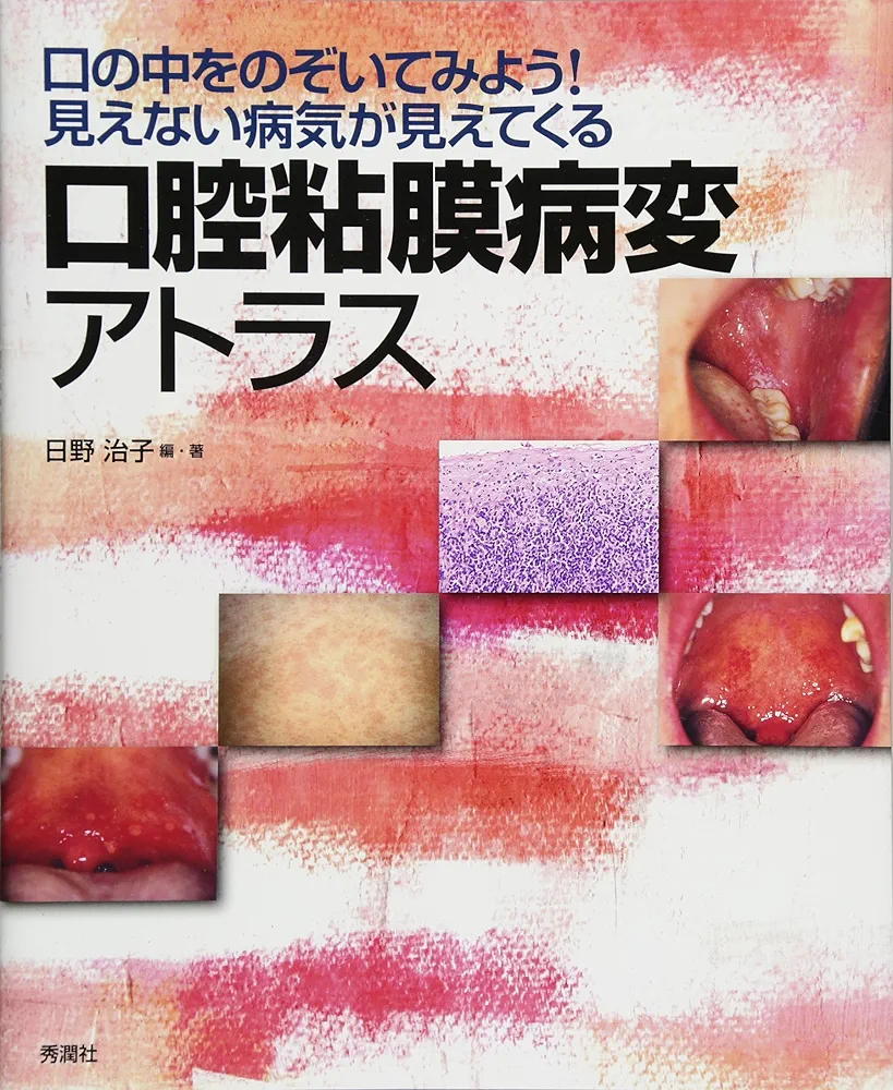 口腔病理アトラス 口腔病理カラーアトラス | 武田 泰典 |本 | 通販 | Amazon