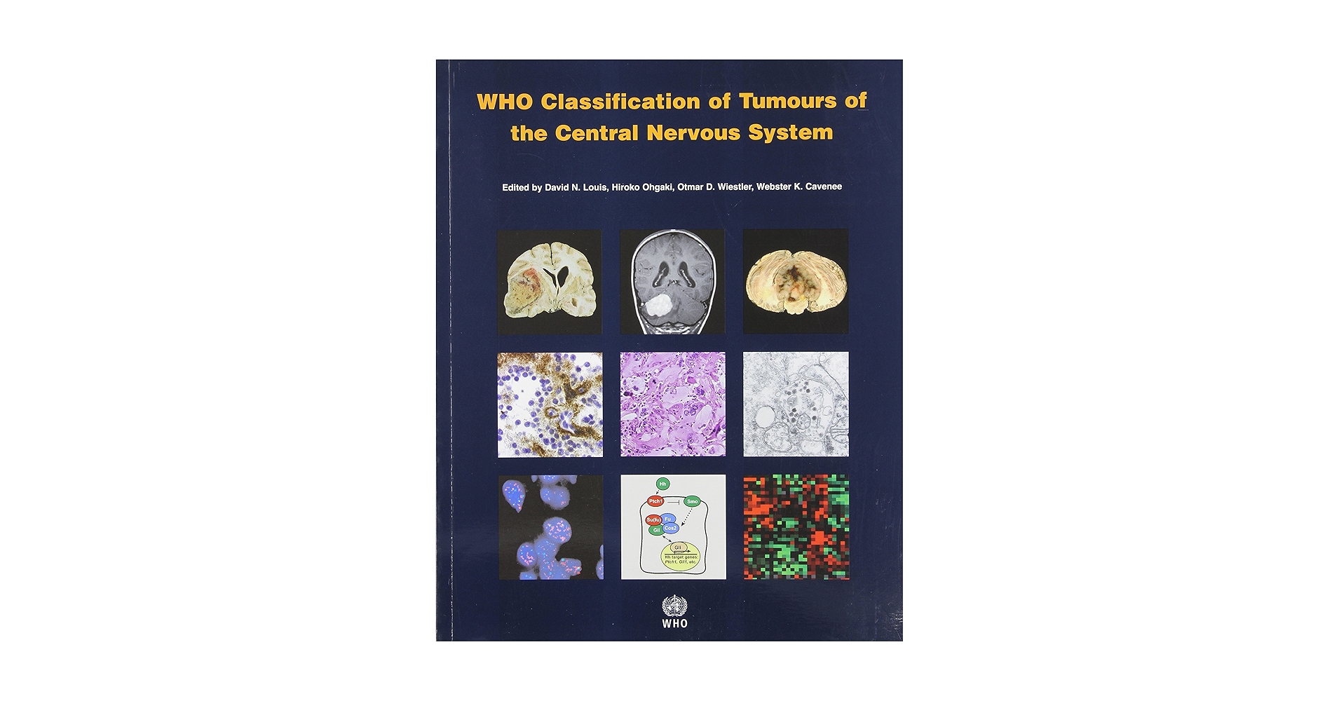 健康・医学 WHO Classification of Tumours WHO Classification of Tumours of Haematopoietic and Lymphoid