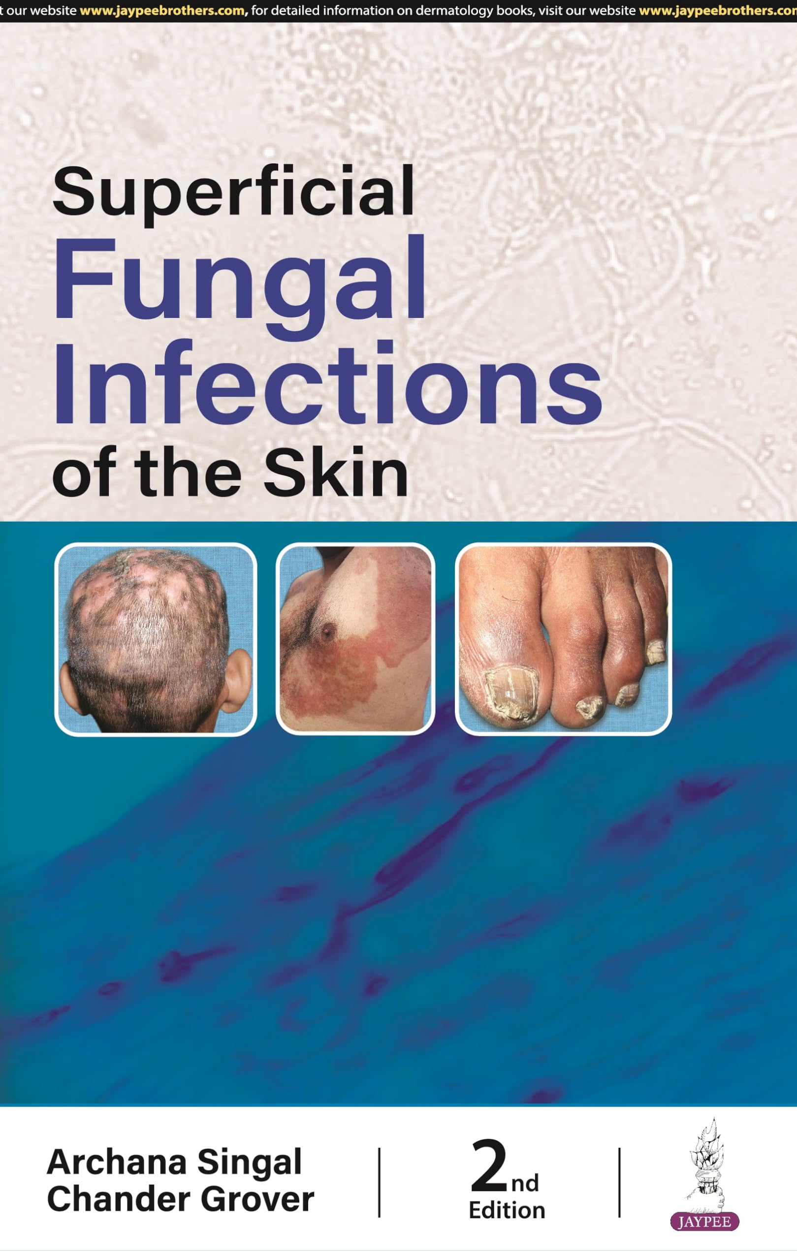 Buy Superficial Fungal Infections of the Skin Book Online at Low Prices ...