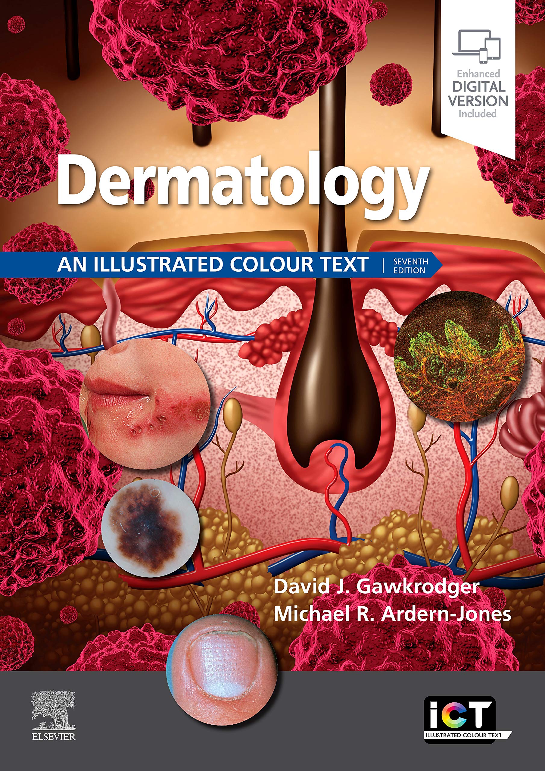 Elsevier Dermatology: An Illustrated Colour Text