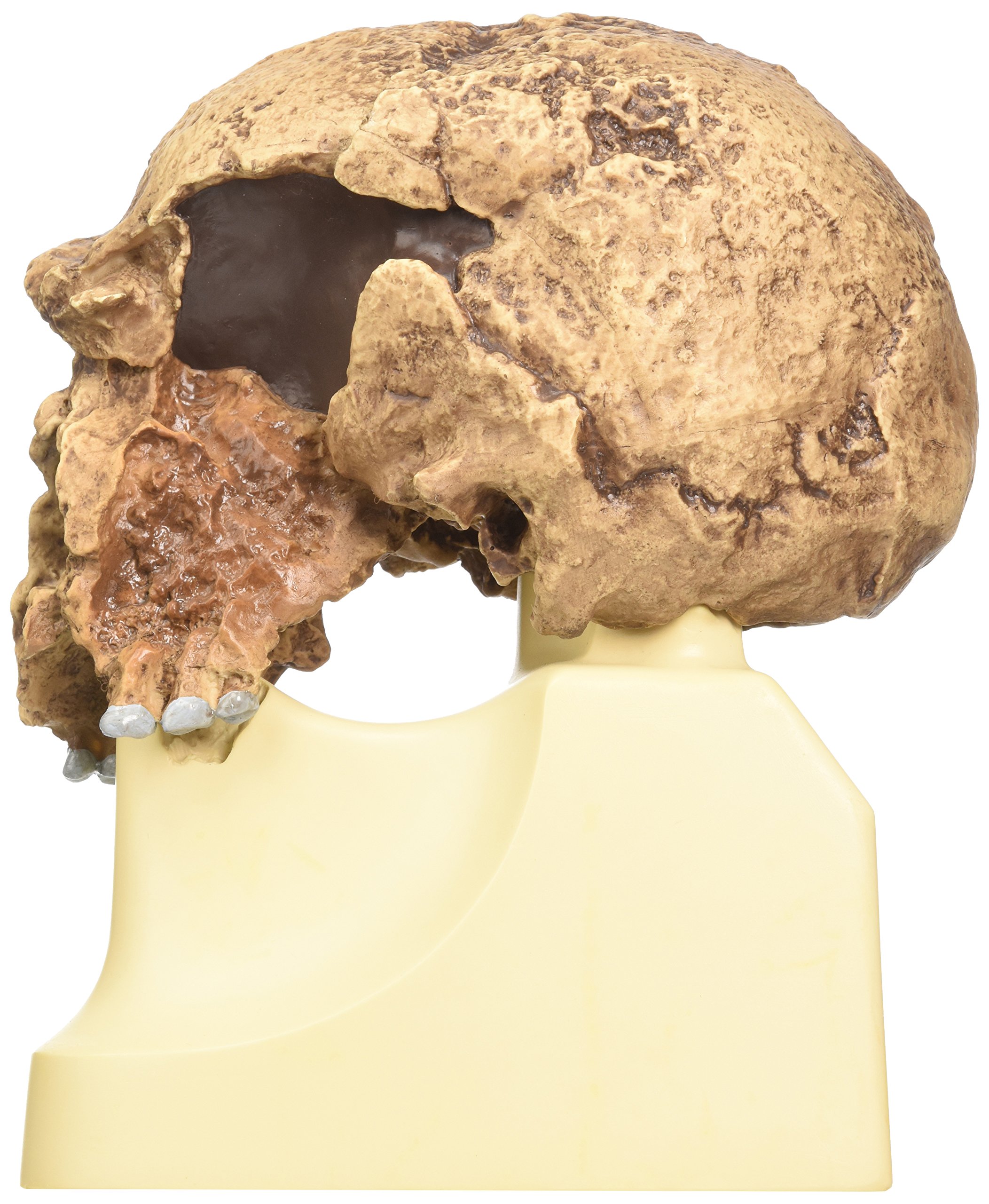 3B Scientific - Schädelreplikat Homo steinheimnensis (Berkhemer, 1936)