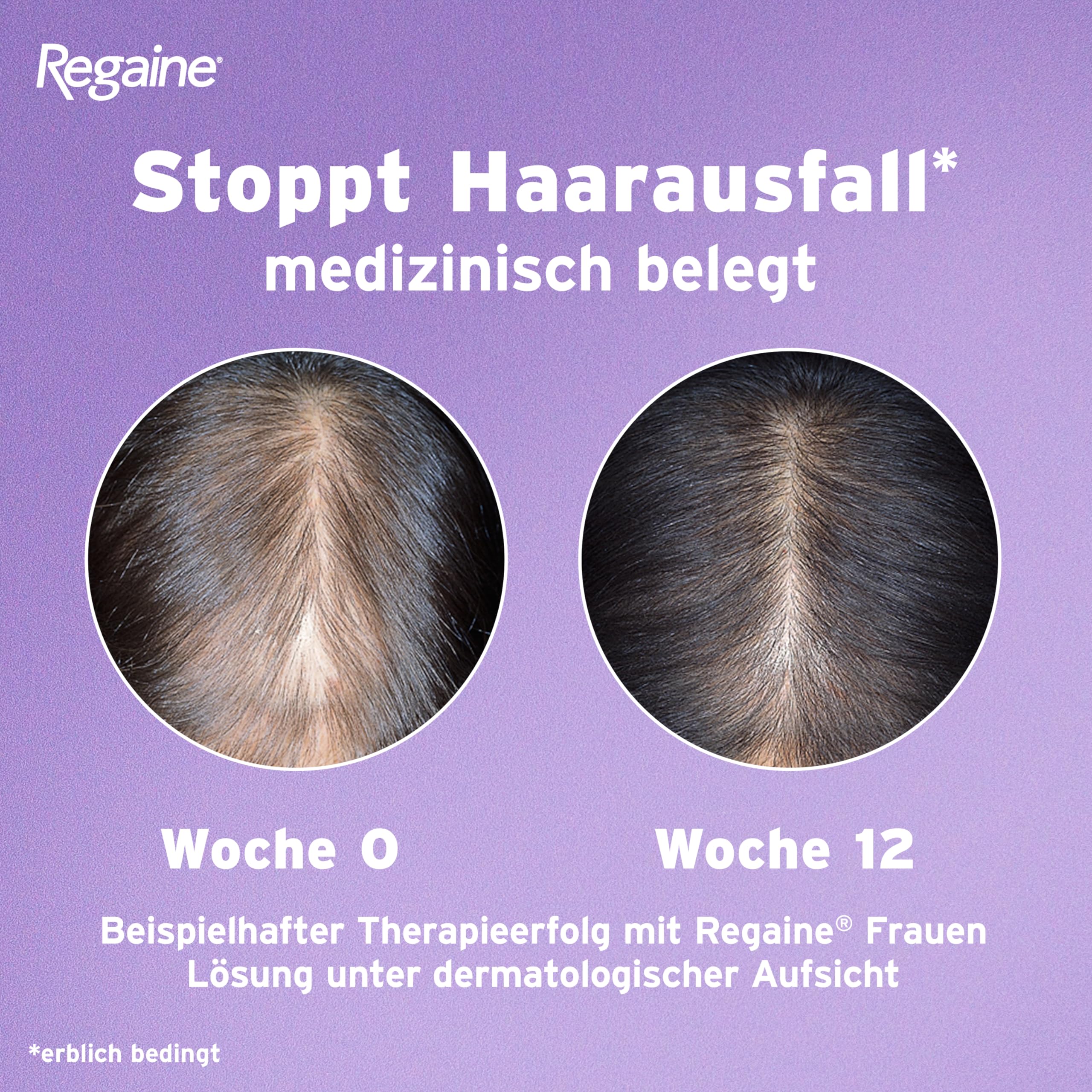 REGAINE Frauen Schaum mit Minoxidil: Stoppt erblich bedingten Haarausfall bei Frauen und regt das Haarwachstum an, 4-Monatspackung, 2 x 60 g