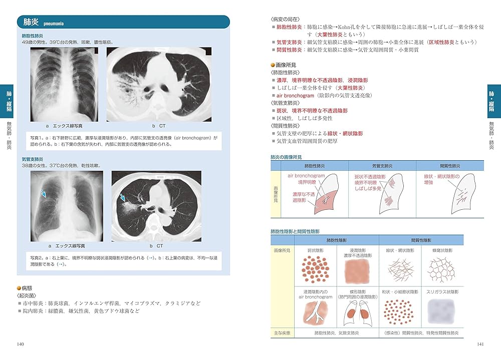 「医学生・研修医のための画像診断リファレンス」 医学生・研修医のための 画像診断リファレンス | 山下康行 |本