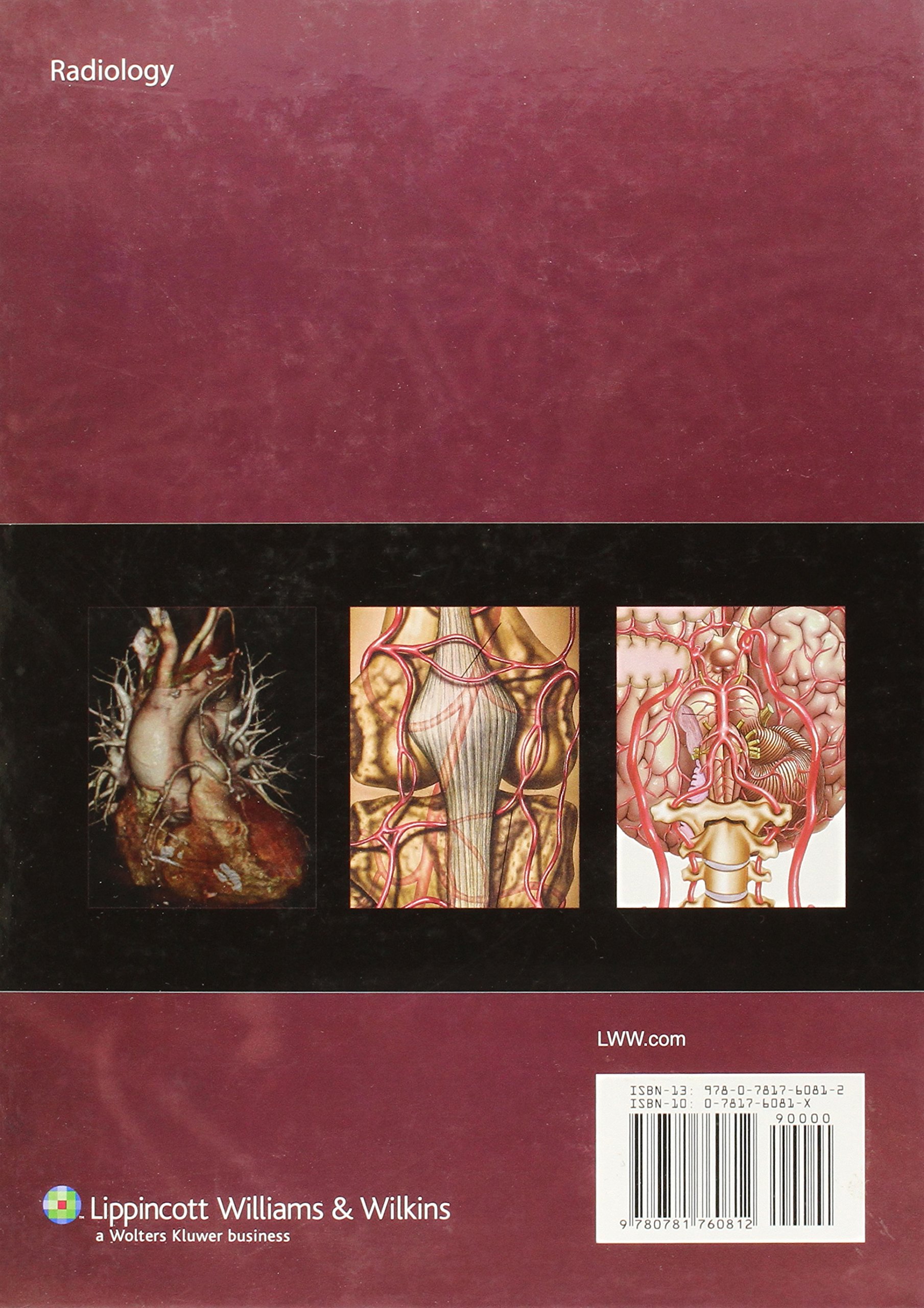 Atlas of Vascular Anatomy: An Angiographic Approach