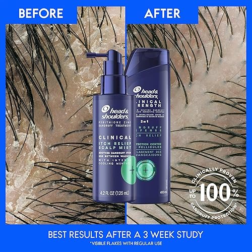 Miniatura 5 de Head & Shoulders Kit de tratamiento de cuero cabelludo seco y caspa, champú y acondicionador de fuerza clínica más niebla clínica para aliviar la