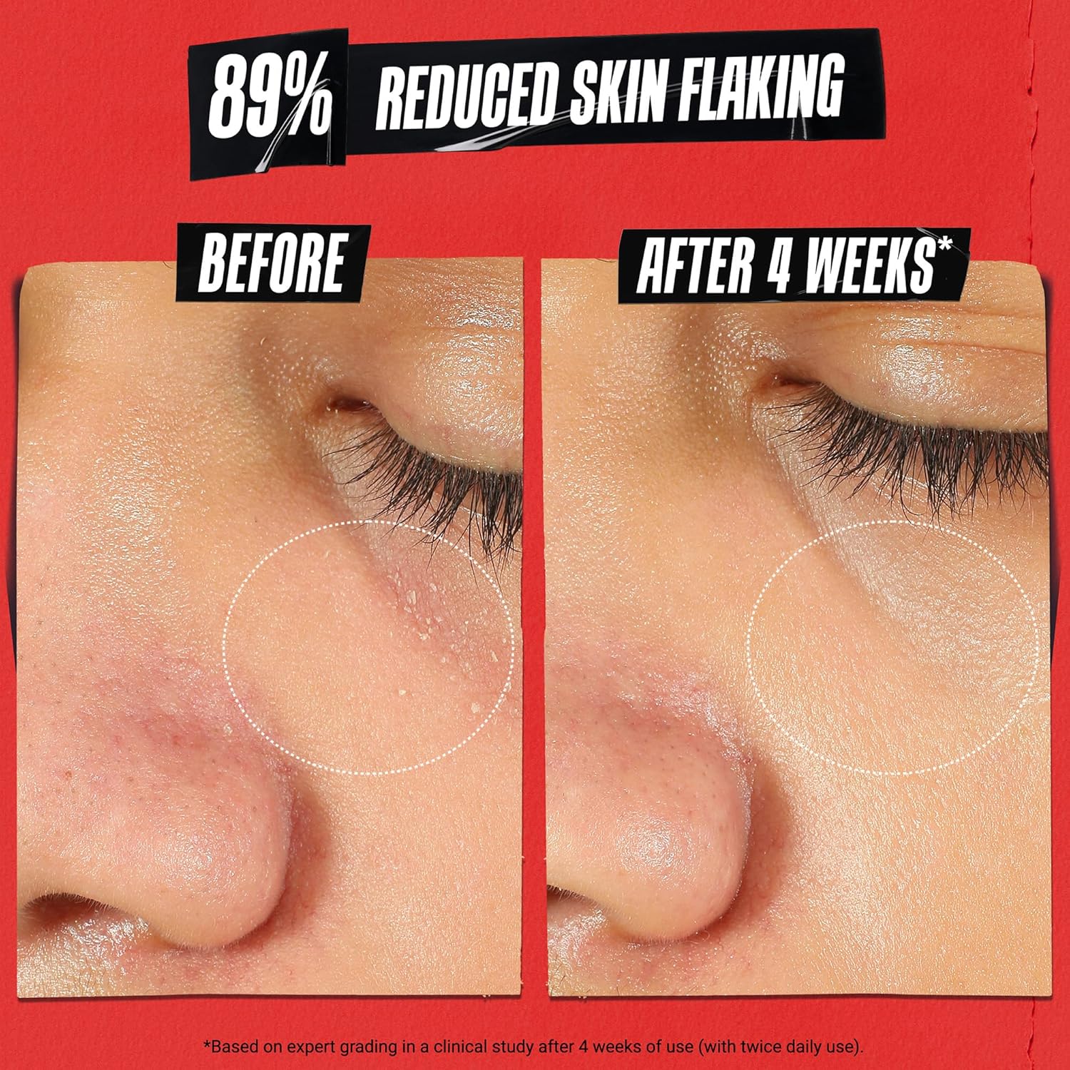 Kiehl's Ultra Facial Recovery Barrier Cream, Lightweight Moisturizing Face Cream, Provides Moisture Boost, Lotion Repairs and Restores Skin Barrier, Suitable for Dry and Sensitive Skin - Image 3