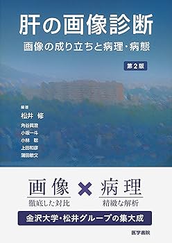 診断病理学：肝胆膵　２版 Hepatobiliary and Pancreas Diagnostic Pathology: Hepatobiliary and Pancreas | ScienceDirect