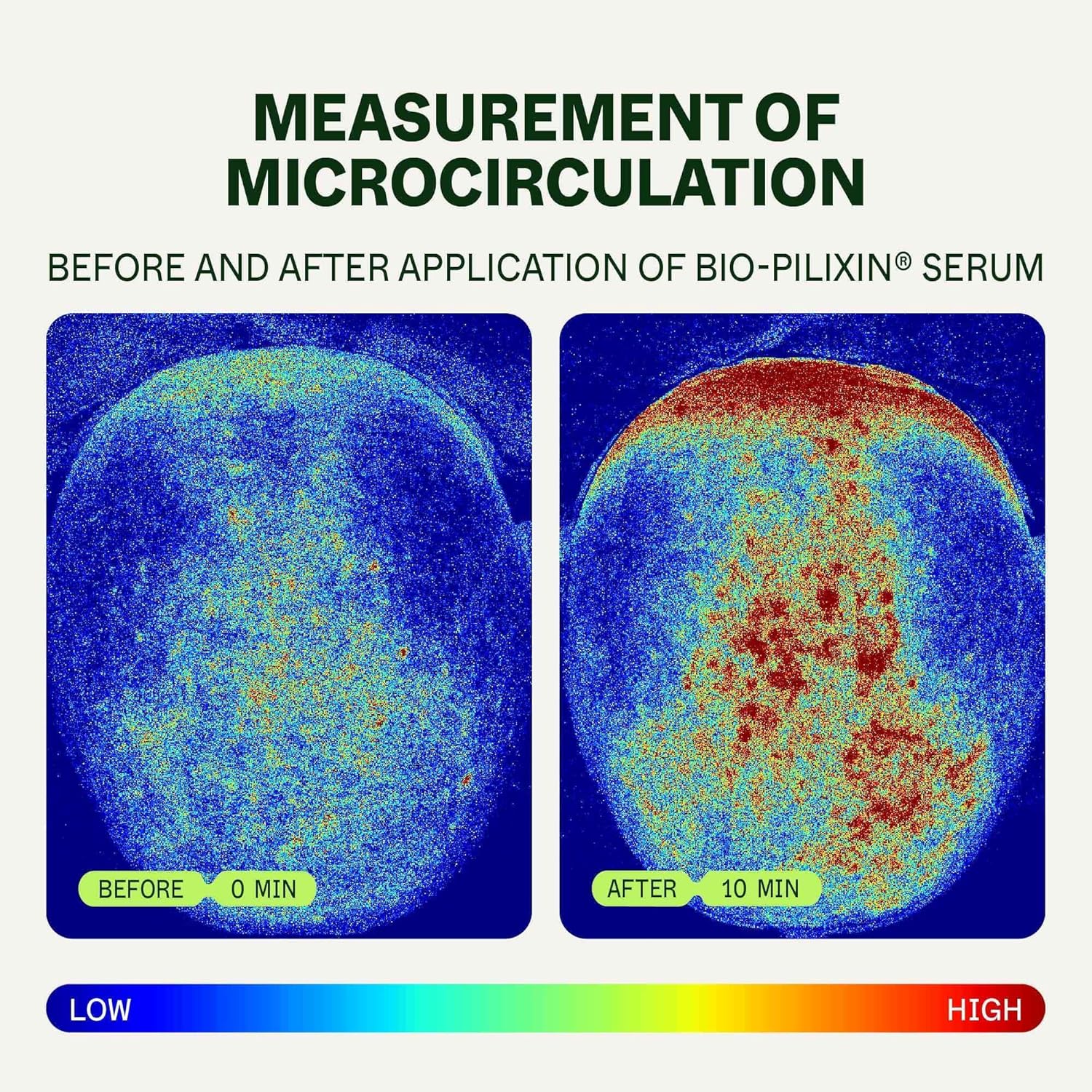 Scandinavian Biolabs Bio-Pilixin® Hairline Booster Refill | Does Not Include Rollerball Applicator | Exosome Hair Activation Formula for Hairline Longevity, 15 mL/ 0.5 oz (Pack of 3) - Image 7