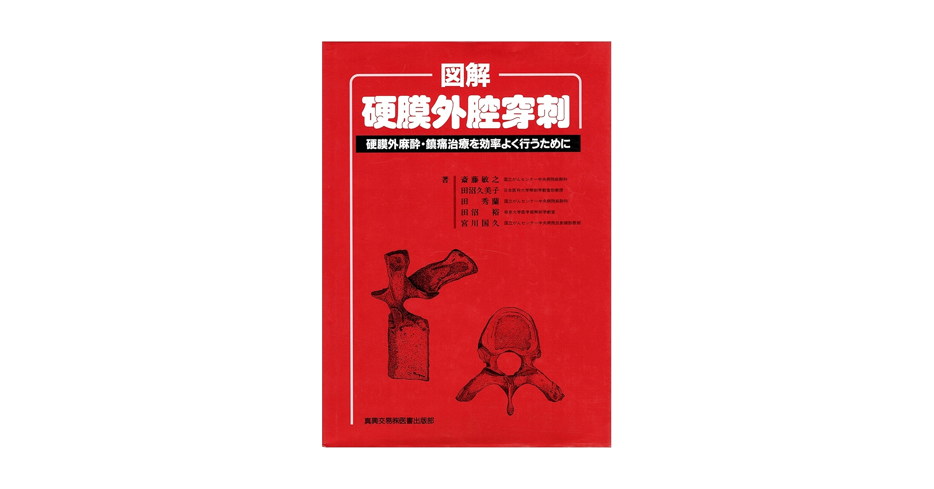 Amazon.co.jp: 図解硬膜外腔穿刺: 硬膜外麻酔・鎮痛治療を効率
