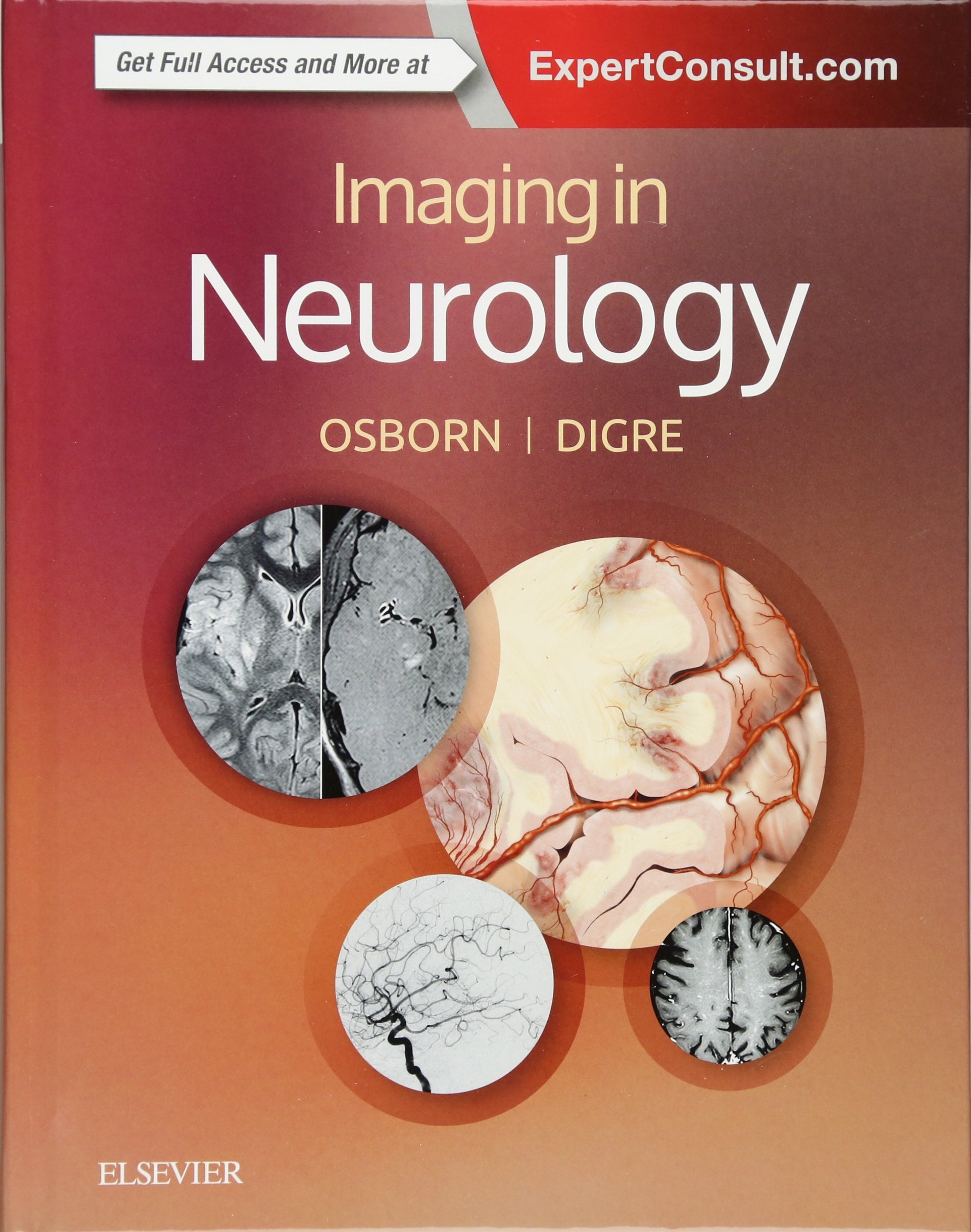 Imaging in Neurology