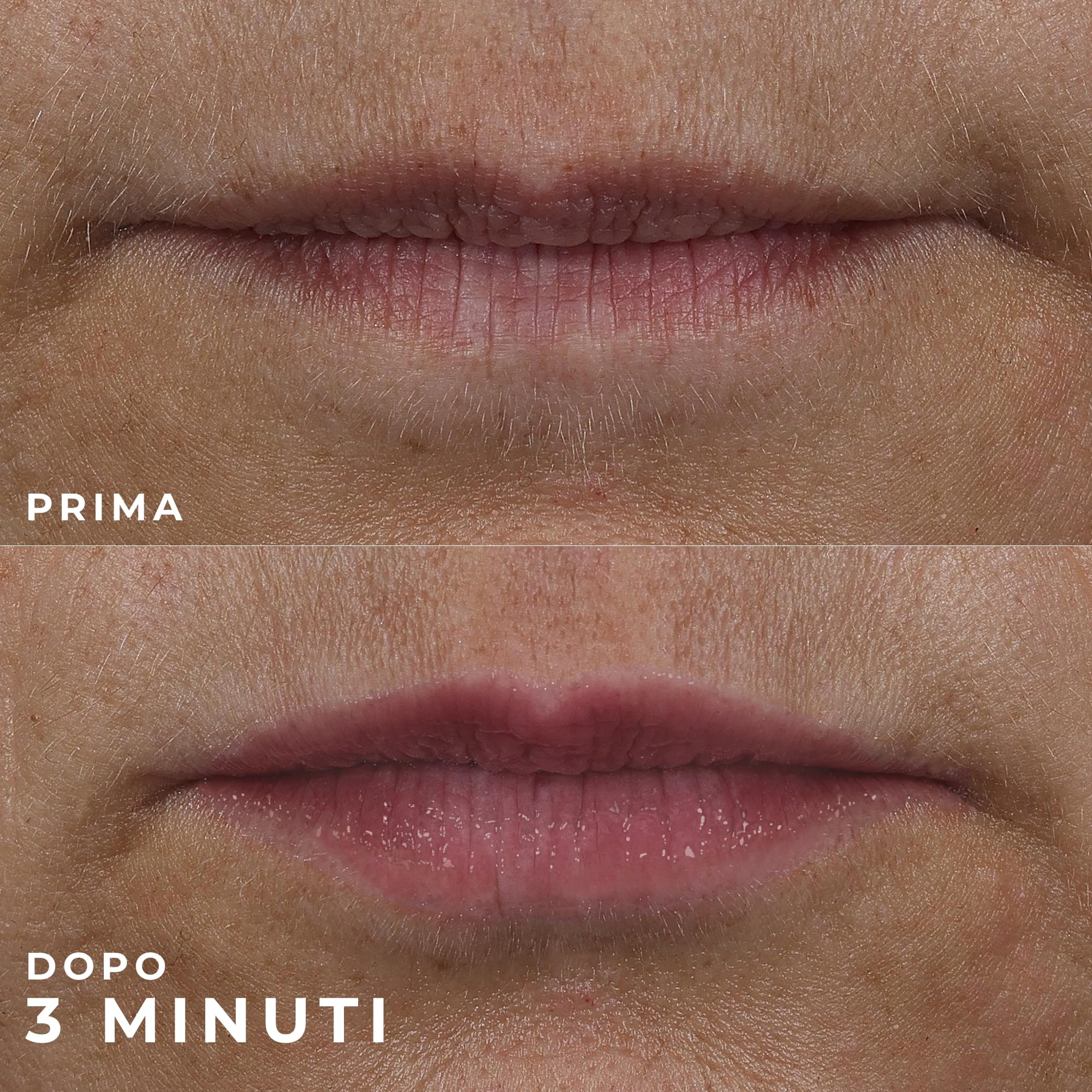 RoC Derm Correxion Volumizzante Labbra | Balsamo Rimpolpante con Acido Ialuronico e Peptidi di Collagene | 10 ml