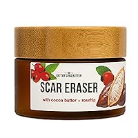 Vista 1 de Better Shea Butter - Mantequilla corporal para eliminar o reducir la apariencia de cicatrices, estrías, marcas de quemadura, cicatrices de acné