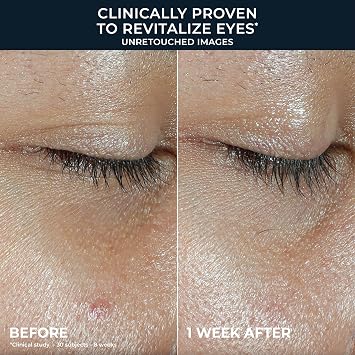 RoC Multi Correxion Revive + Glow Eye Balm, 4 g | Cooling Stick for Dark Circles & Puffy Eyes, with Peptides & Antioxidants, Suitable for Sensitive Skin, with Vitamin C