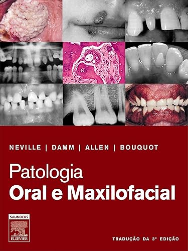 Patologia Oral e Maxilofacial