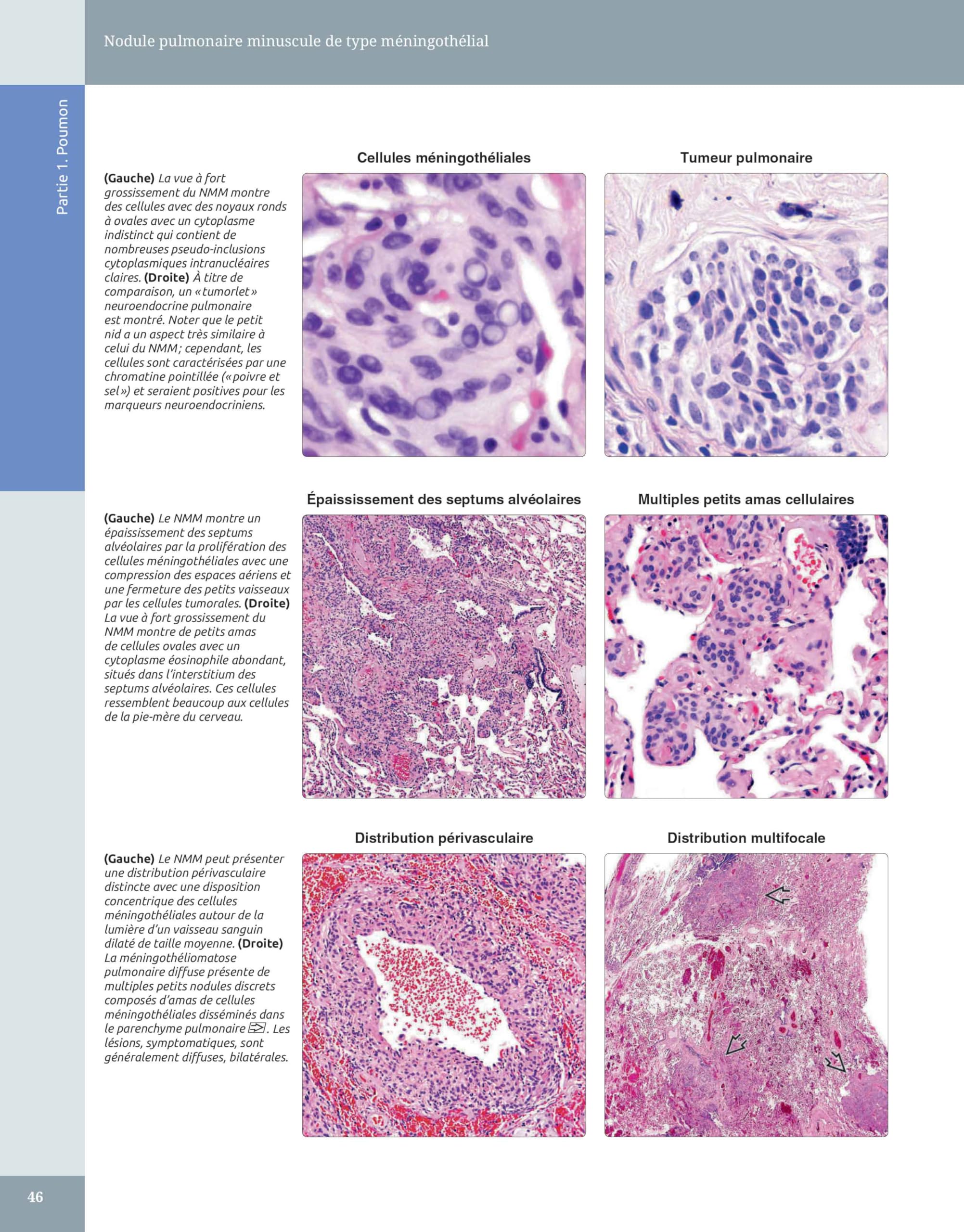 Diagnostic en pathologie thoracique