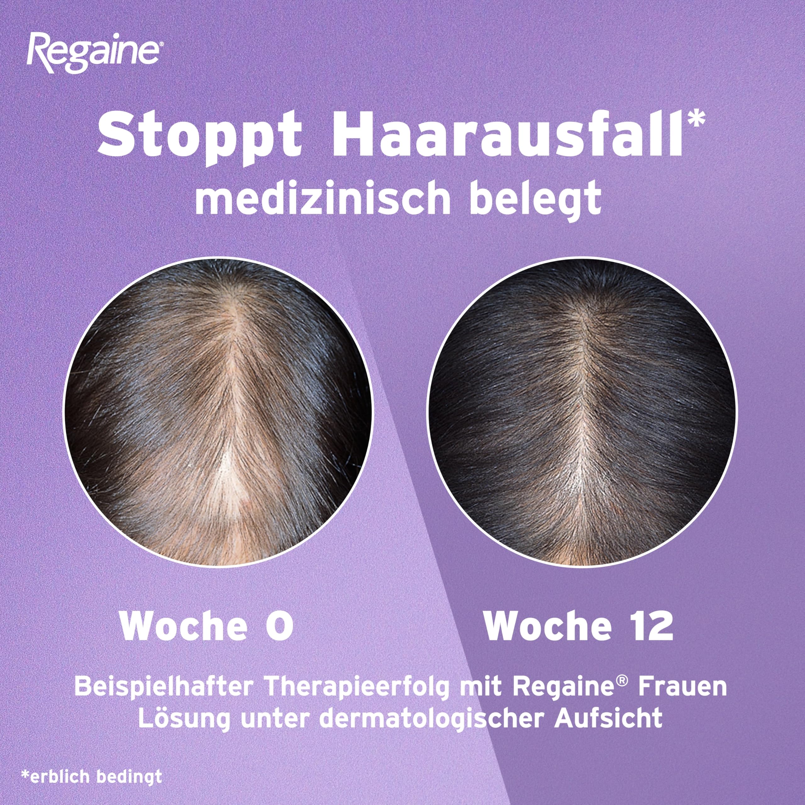 REGAINE Frauen Lösung: Mit 20 mg/ml Minoxidil bei erblich bedingtem Haarausfall, stoppt den erblich bedingten Haarausfall und regt neues Haarwachstum an, 6-Monats-Vorrat, 6 x 60 ml