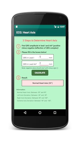 ECG: Heart Axis