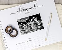 Vista 14 de Personalized Twin Pregnancy Journal (8 Center Designs) - Hardcover Pregnancy Memory Book Customized with Babies’ Names, Nicknames or Phrase