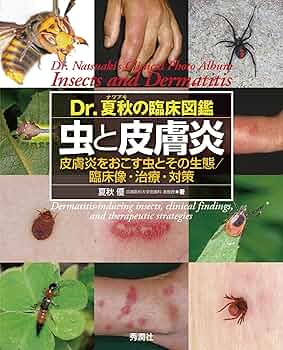 Dr.夏秋の臨床図鑑 虫と皮膚炎 61bxiJyFlaL._AC_UF350,