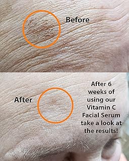 VITAMIN C Serum 1 oz. Abrillantador de piel a...