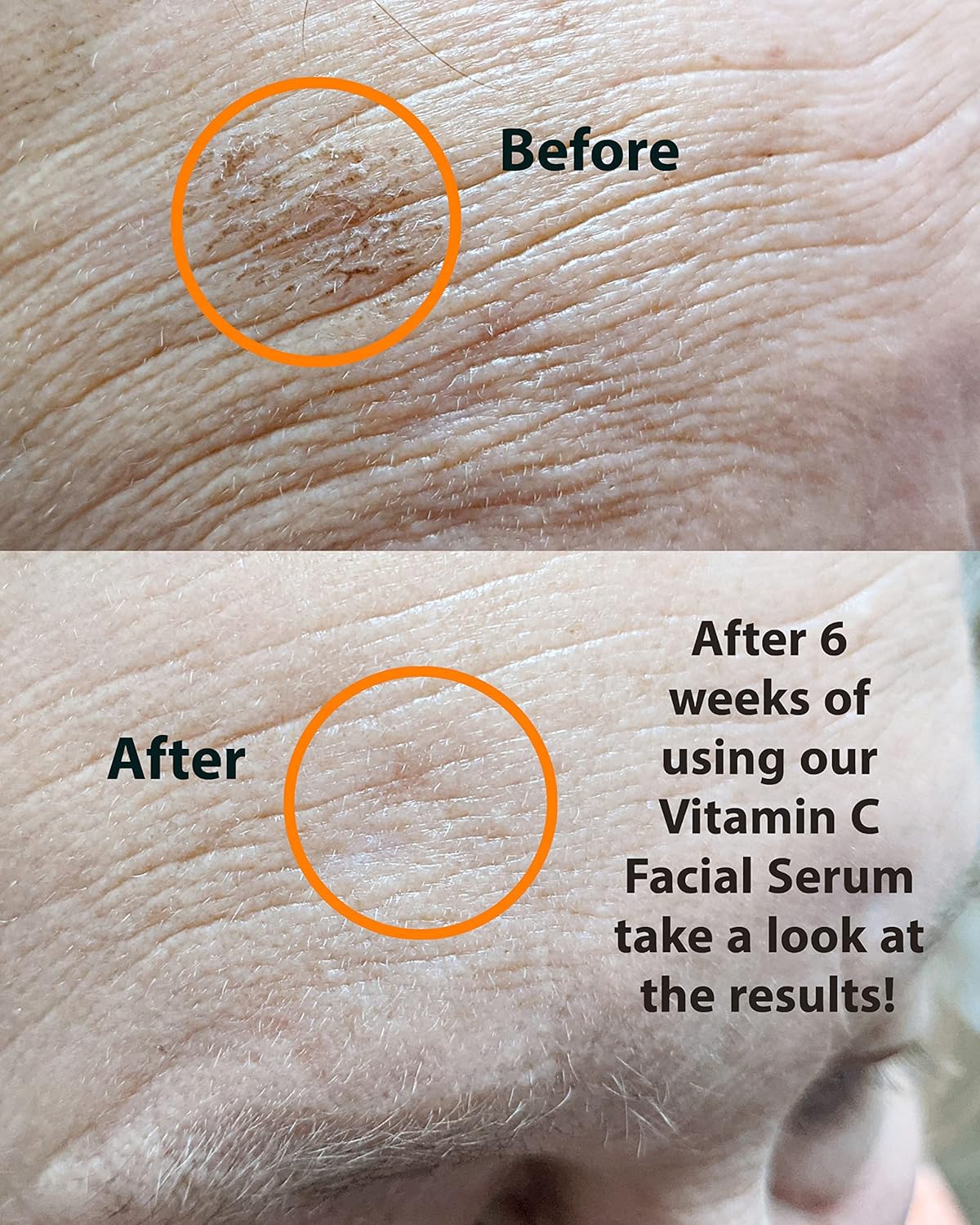 VITAMIN C Serum 1 oz. Anti-Aging Skin Brightener with Hyaluronic Acid and Collagen Boosting Peptides