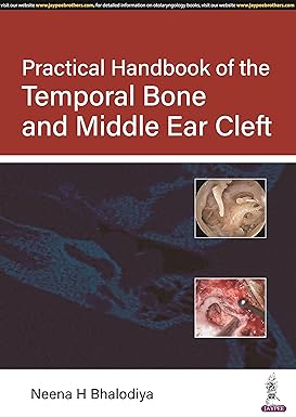 PRACTICAL HANDBOOK OF THE TEMPORAL BONE AND MIDDLE EAR CLEFT