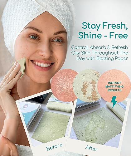 Miniatura 6 de Kit de removedor de puntos negros con papel secante de control de aceite 50 hojas  Popper de espinillas de acero inoxidable, kit de extracción de