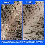 Shampoing Head & Shoulders Lisse & Soyeux, 613 mL Blanc,Bleu,Rose,1