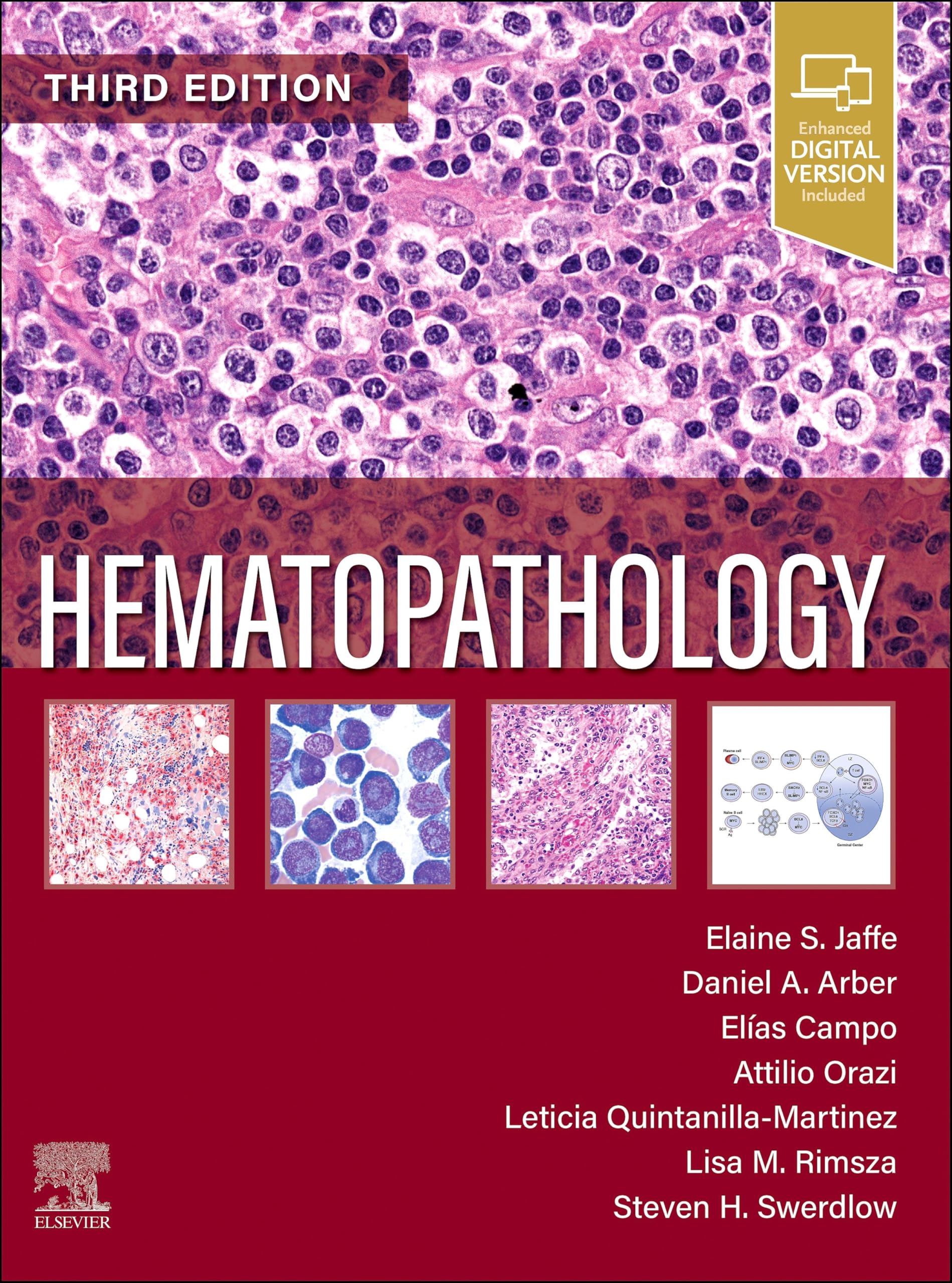 Hematopathology - E-Book (English Edition)