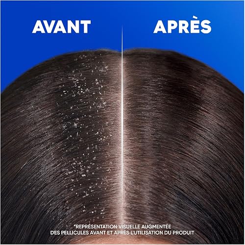 Head & Shoulders Menthol Fresh Shampoing Antipelliculaire 330ml Usage Quotidien. Jusqu'à 100% Des Pellicules Éliminées, Cliniquement Prouvé. Tous Types de Cheveux et de Cuir Chevelu - 4