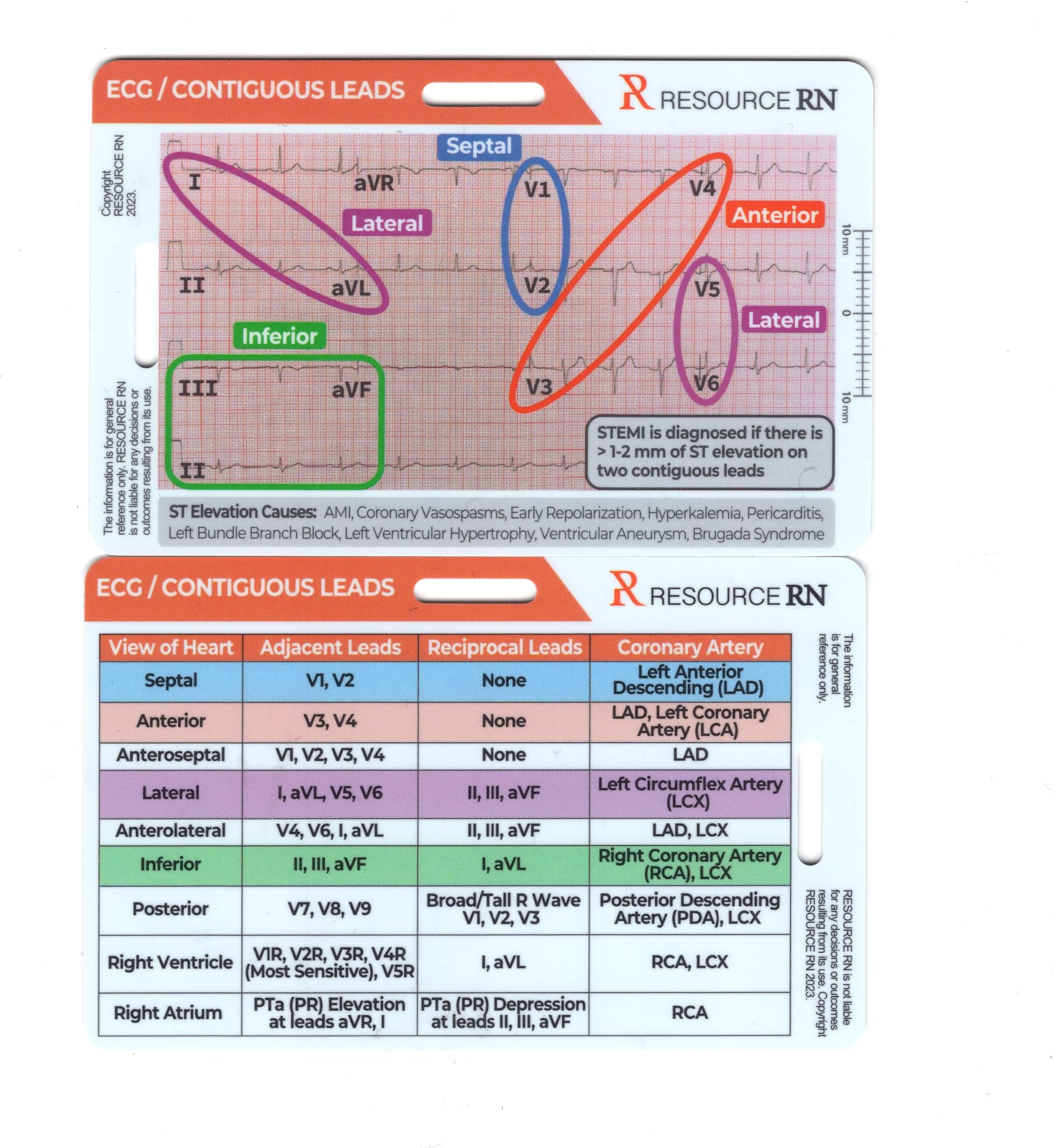 EKG STEMI Analysis Badge Card for Rapid Interpretation – Compatible for Both Horizontal & Vertical Layout
