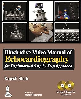 Illustrative Video Manual of Echocardiography for Beginners
