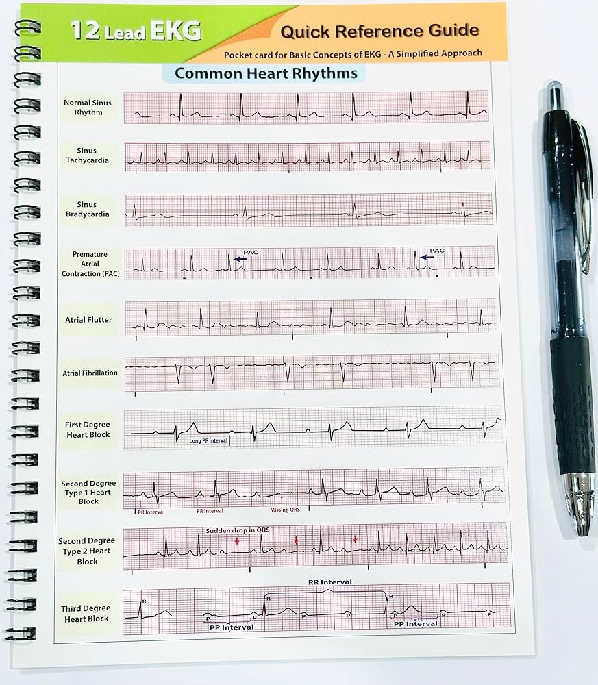 Amazon.com: 12 Lead EKG Pocket Card: 9781941004067: APRN World: Books for Free Printable Ekg Practice Strips