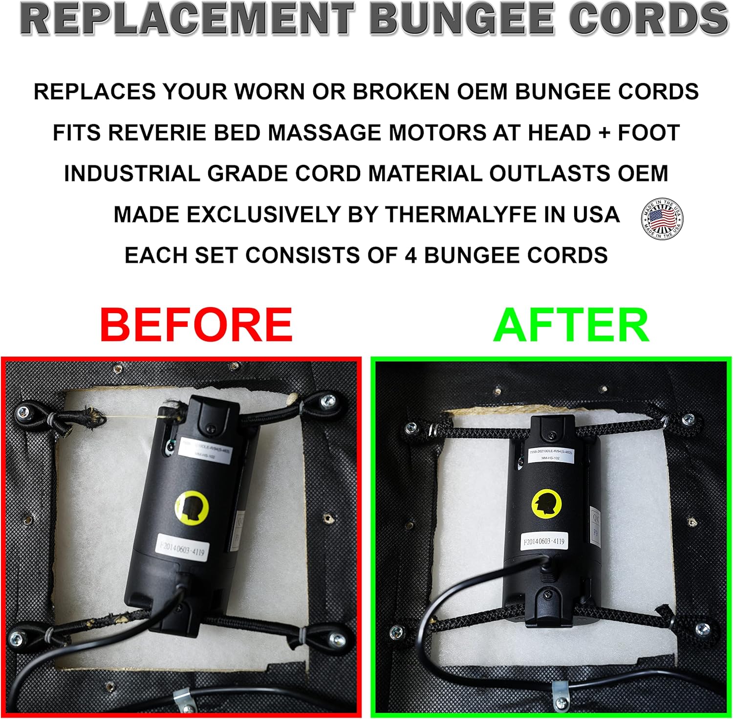 4-Pack Replacement Bungee Cords for Reverie Motorized Head and Foot Massage Vibration Motors
