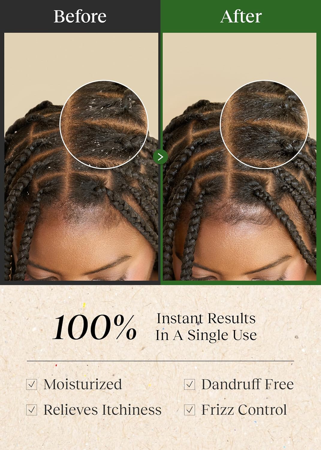 Bephor Braid Rev Scalp Cleansing Toner Pad, Travel Kit, No-Rinse Exfoliator image 5