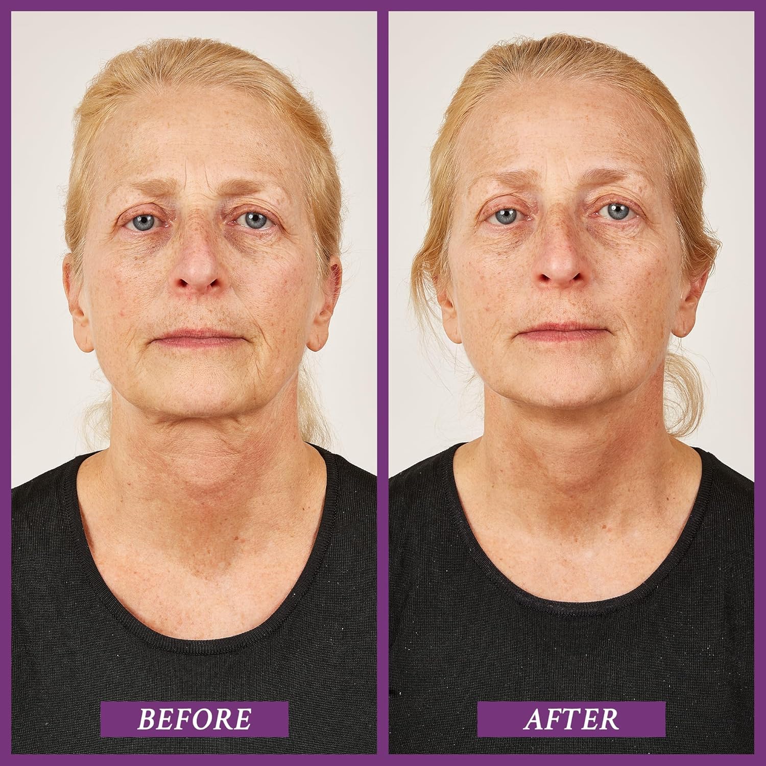 PRAI Beauty Ageless Throat Caviar Overnight Recovery Serum for Instantly Ageless Neck, Neck Firming and Tightening Serum, 1.7 Oz - Image 3