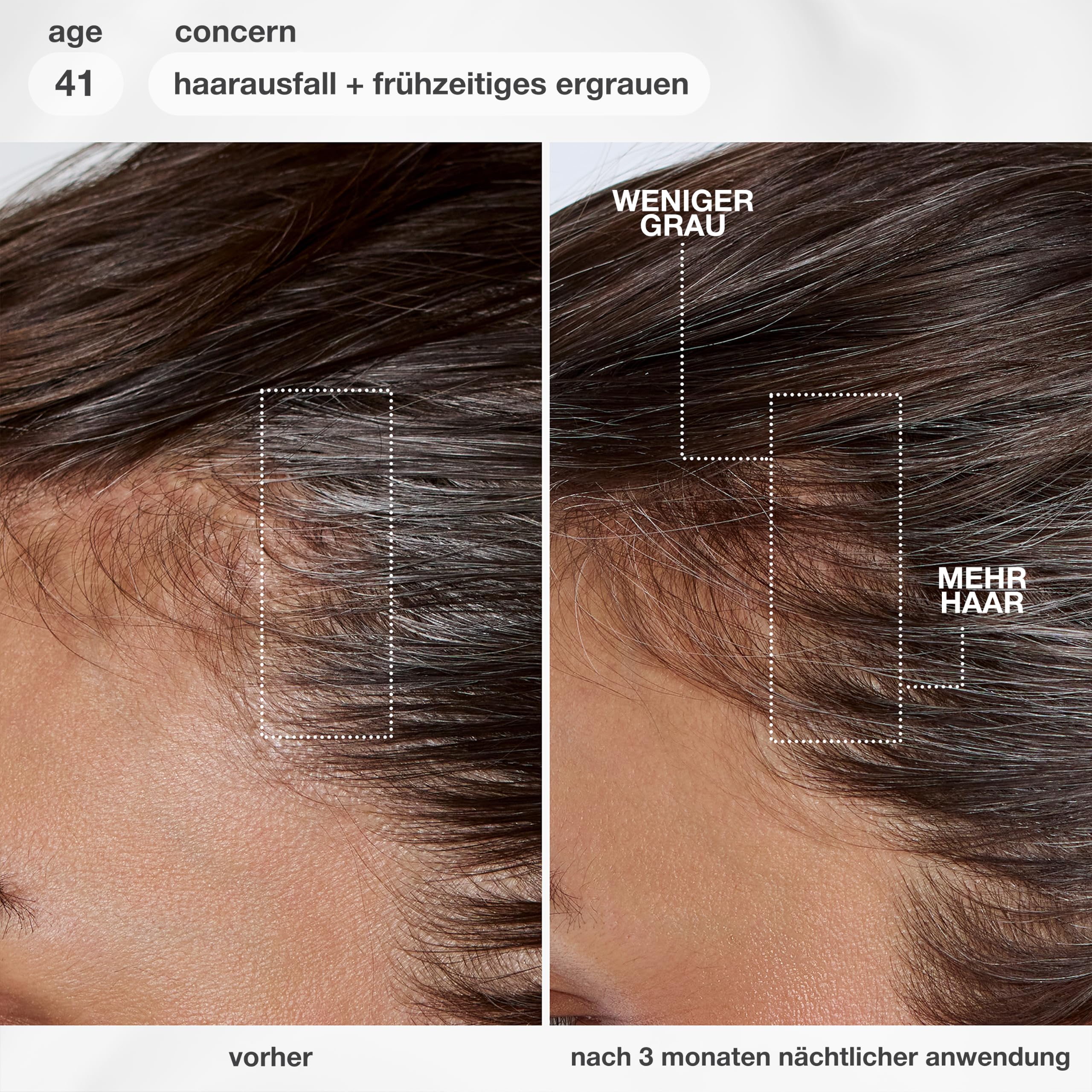 K18 FutureIQ Biomimetisches Kopfhautserum für Haarlanglebigkeit, 90 ml | Mit MultiVital Tech für bis zu 19.000 mehr Haare, weniger graue Haare, stärkere Kopfhautbarriere, parfümfrei & vegan