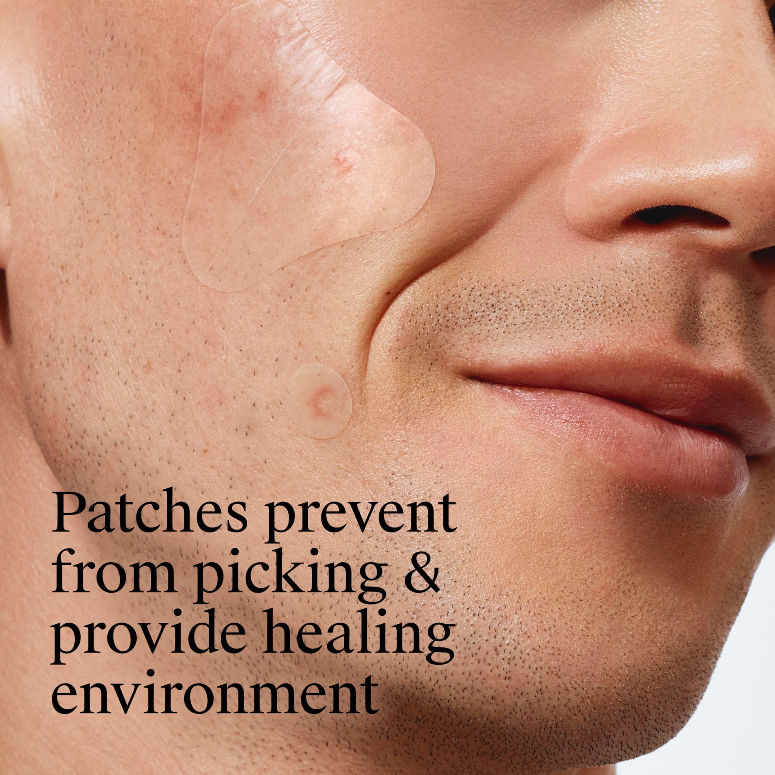 Neutrogena Acne Patches - Shrink Pimples Overnight -3 Neutrogena Acne Patches - Shrink Pimples Overnight -3