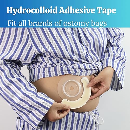 Miniatura 5 de 40 tiras de barrera para ostomía con huecos, suministros elásticos de urostomía de ileostomía, cintas extensoras de barrera cutánea para bolsas de